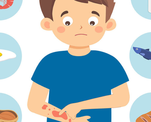 Food Allergies Featured Image