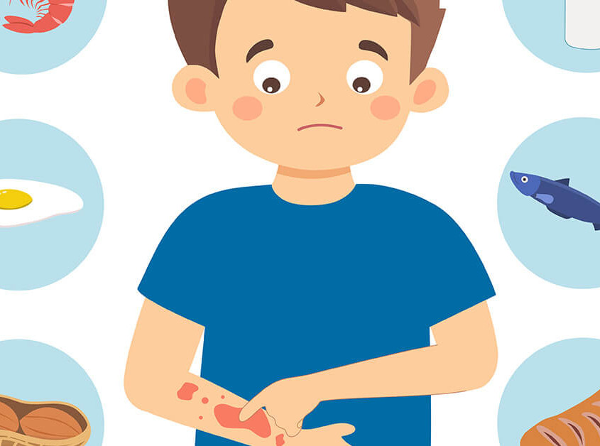 Food Allergies Featured Image
