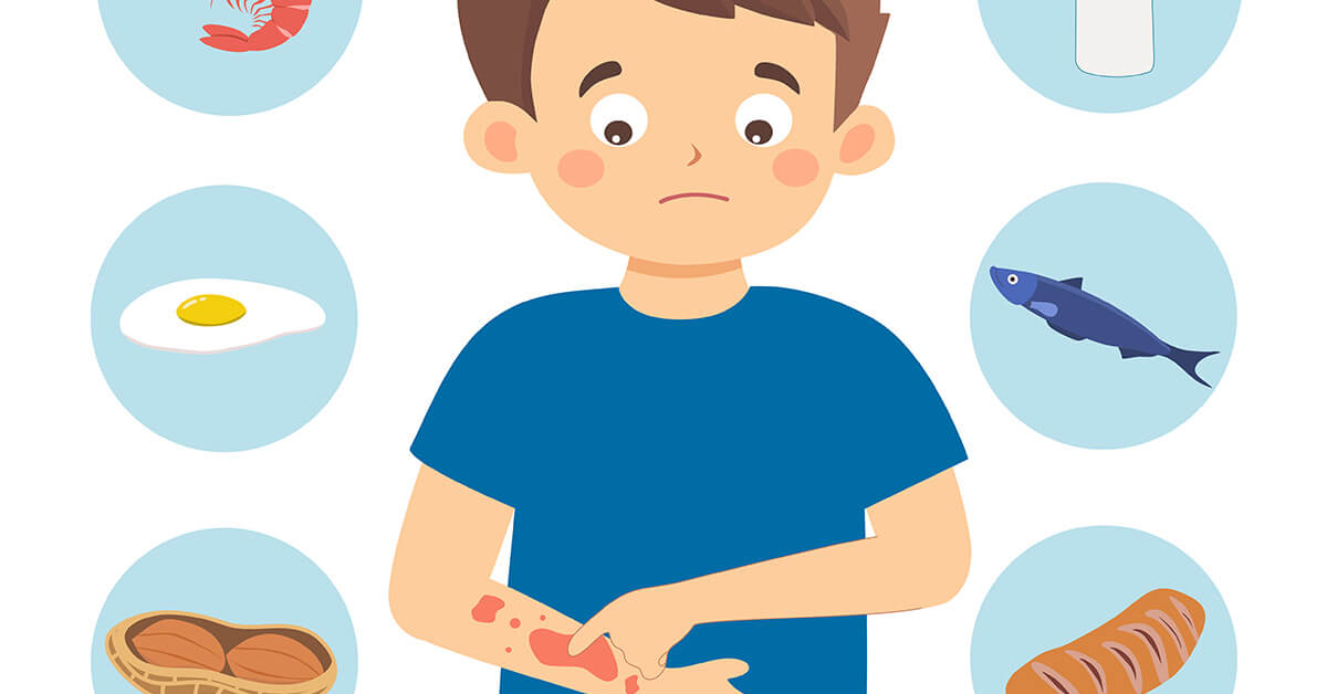 Food Allergies Featured Image